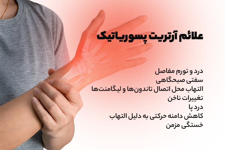علائم آرتریت پسوریاتیک